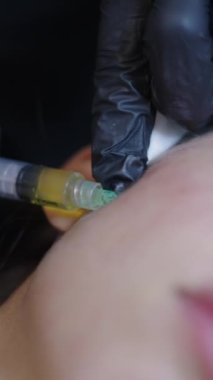 Prp enjeksiyonu alan güzel bir kadının yüzü - FHD dikey video