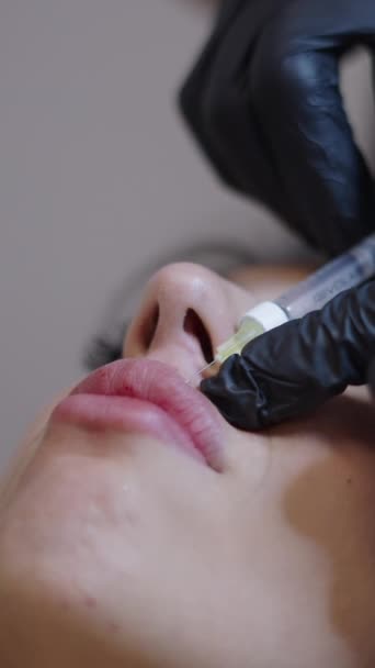 Dokter Menyuntikkan Asam Hialuronat Dalam Wanita Bibir Atas Konsep Perawatan — Stok Video
