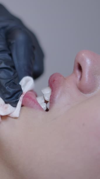ドクターは痛みを震える少女の唇領域をきれいにする ヘルスケアの概念Fhd垂直 — ストック動画