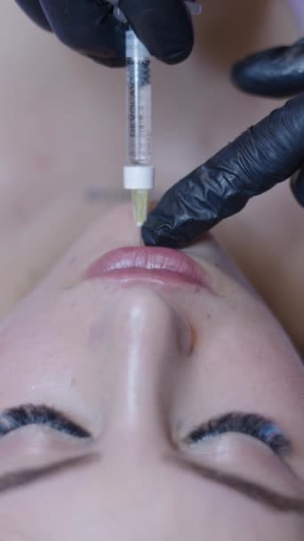 医生将透明质酸注入病人下唇保健概念Fhd垂直注射 — 图库视频影像
