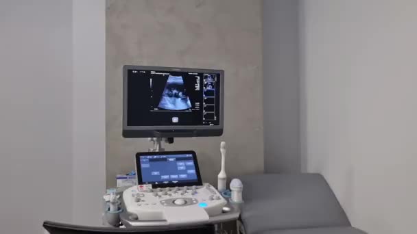 Varsó Lengyelország 2024 Április Ultrahang Monitor Magzati Képekkel Ultrahang Berendezés — Stock videók