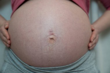 Genç bir kadın hamile karnında ellerini tutuyor. Hamile bir anne. Hamilelik nedeniyle gerilmiş göbek deliği