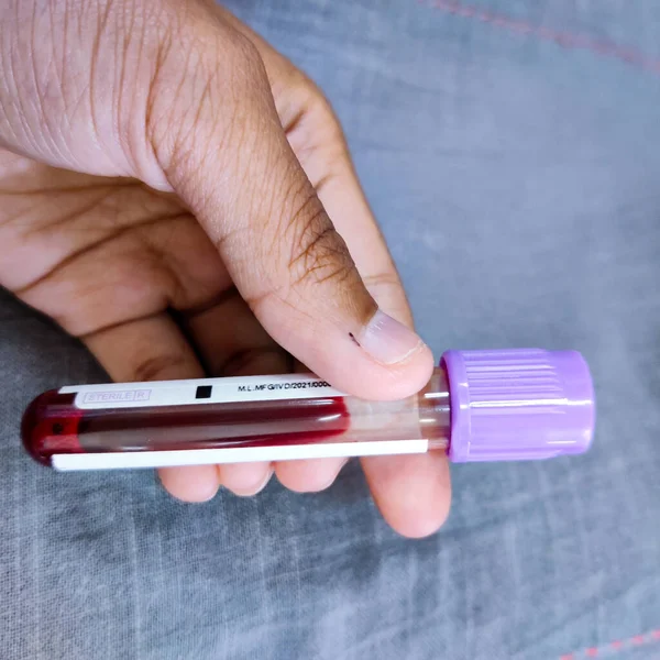 Elimizdeki kan testi tüpünün yakın plan çekimi. 