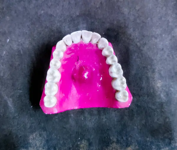 Oyuncu kadrosundaki Torus Palatinus 'un seçici odak resmi