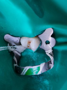 diş ve diş bakımı