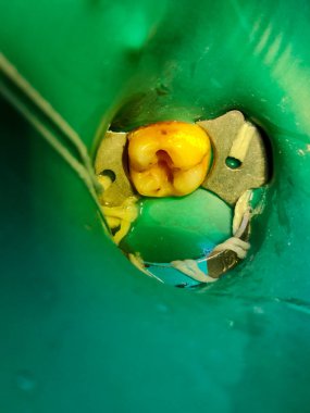 Lezzetli Asya yemeklerinin yakın görüntüsü