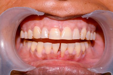 yakın çekim - insan dişlerinin fotoğrafı