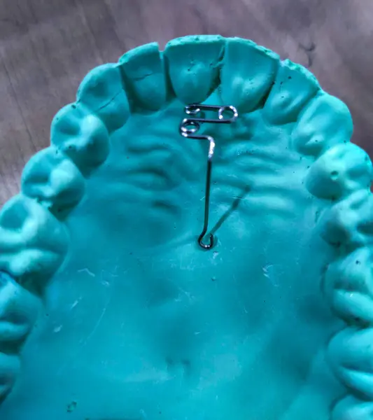 Ortodontik aygıtın seçici odak resmi Z yayı üstüste