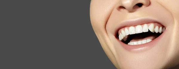 用复制空间裁剪妇女的半人半人像 乳齿美容院 美丽的巨无霸与完美的白牙与科皮空间 牙齿美白及健康治疗 — 图库照片