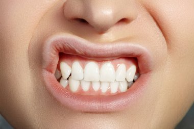 Kesilmiş yarım yüzlü kadın portresi. Yakın plan Diş Güzeli. Mükemmel beyaz dişli güzel Macro. Beyaz Diş, Ağız Temizliği, Sağlık Tedavisi. Beyaz Diş ve Sağlık Tedavisi