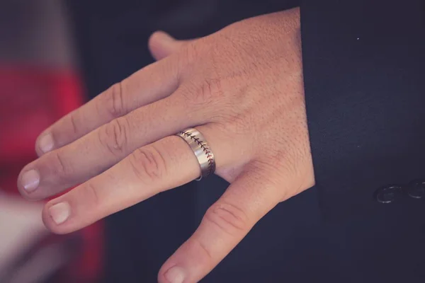 Hand Van Een Man Met Een Ring Zijn Ringvinger — Stockfoto