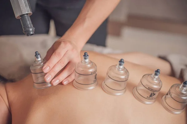 Masseur Using Cupping Therapy Her Client — Stock Photo, Image