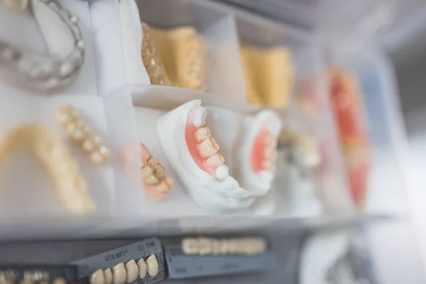 Close Várias Próteses Dentárias Diferentes Características Conceito Saúde Dentária — Fotografia de Stock