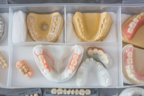Nahaufnahme Verschiedener Zahnersatz Mit Unterschiedlichen Merkmalen Konzept Der Zahngesundheit — Stockfoto