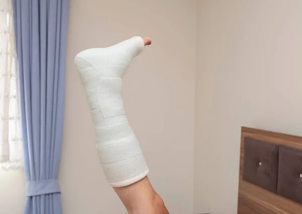 Розбитий Щиколотки Ноги Розщеплення Пов Язки Ньому — стокове фото