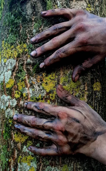Vertikální Záběr Špinavých Rukou Kůře Stromu Pokryté Mechem — Stock fotografie