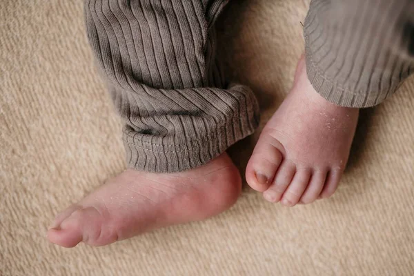 Ein Blick Von Oben Auf Die Nackten Zehen Des Neugeborenen — Stockfoto
