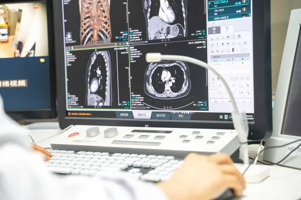 stock image A doctor analysing the test result from MRI Scaner on computer