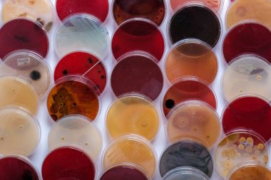 Bakteriyel Büyüme ile Çoklu Petri Tabaklarının Tam Çerçeve Görünümü