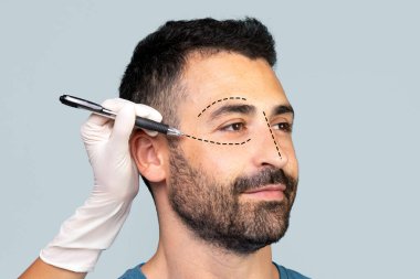 Estetik cerrah estetik ameliyat için adamın yüzüne izler çiziyor. Gri stüdyo arka planında poz veren yakışıklı adam estetik ameliyata ya da yüz gerdirmeye hazırlanıyor. Yüksek kalite fotoğraf