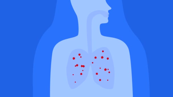Animation Lung Disease Respiratory System Coronavirus Bacteria Lungs Illustration Course — Wideo stockowe