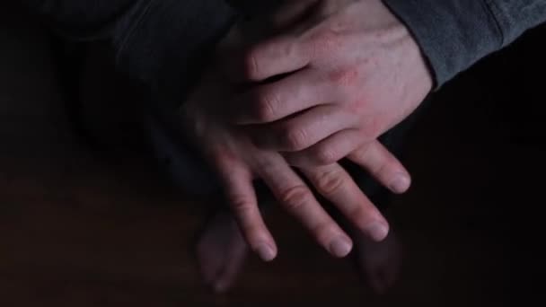 男人的手彼此擦伤 这是一种手部皮肤的疾病 疥疮被寄生虫或蚊子叮咬的疥疮痒的手 高质量的4K镜头 — 图库视频影像