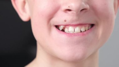 Bir erkek ya da genç anormal büyümüş bir köpek dişi gösterir. Dişçiler için gösteri videosu. Yüksek kalite 4k görüntü