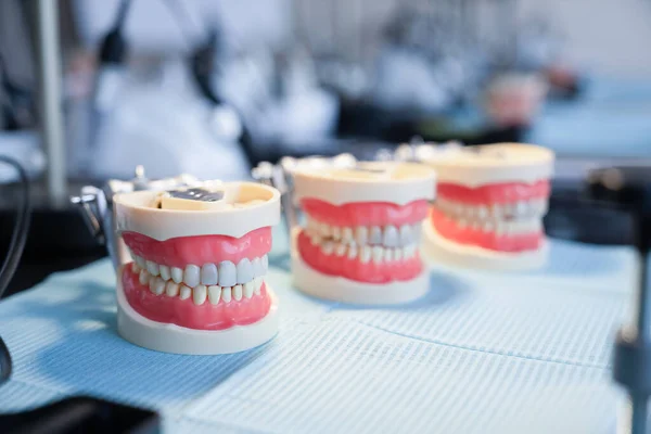 Models Human Jaw Teaching Dentists — Stock Photo, Image