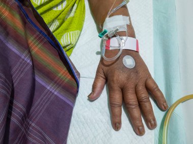 Endonezyalı yaşlı bir kadının elinde, hastanede serum damlatırken yakın çekim. Hasta tıbbi tedavi görüyor, yaşlanma ve bakım belirtileri gösteriyor..