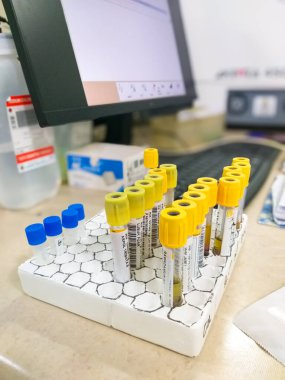 Klinik laboratuarında test tüpünde sarı ve mavi başlıklı kan örnekleri. Kan toplama ve teşhis testlerinde kullanılır.
