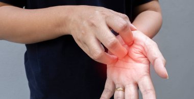 Yakındaki kadın tırnaklarıyla elini tırmalıyor. Ani, iltihaplı vücut parçaları rahatsızlık ve kaşıntıya neden olur. Genç bayan alerji nöbetlerinden muzdarip. Dermatolojik deri hastalıkları kavramı.