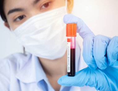 Medical or scientific researcher or woman doctor looking at a test blood tube of clear solution in a laboratory.