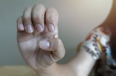 Doğal çivi kavramı, çiğ çivi. Asyalı kadın elinin doğal cilalanmamış tırnakları, bej arka planda aşırı büyümüş tırnak derisi..