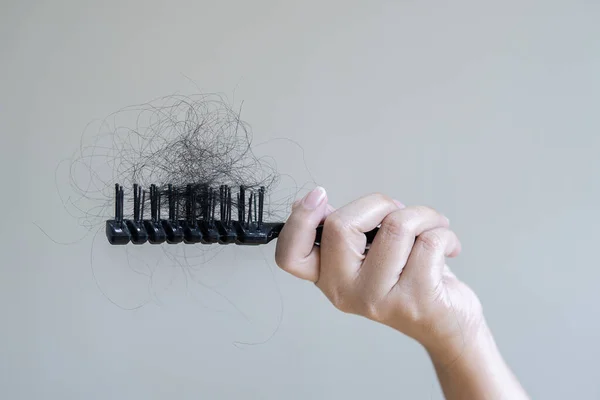 Woman show her brush for presentation of many hair fall after combing in hairbrush. Hair loss problem.