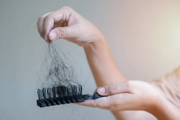 Woman losing hair on hairbrush in hand. Hair loss problem concept. Soft focus.