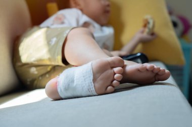 Yaralı çocuğun ayağının seçici odağı bir doktor tarafından tedavi edilmiş. Tıbbi konsept.