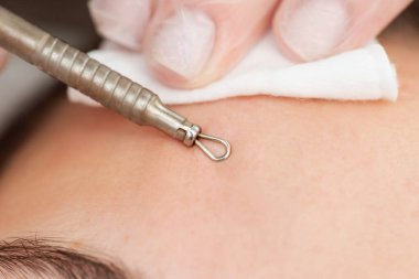 Güzellik salonundaki siyah başlıklı kadın yüzünü iyice temizleyin. Kapatın. Siyahların derilerini yüzmek için çelik alet ve kozmetolojistlerin sivilcelerini kullanmak.