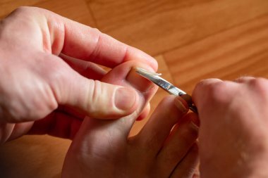 Bir adam büyük ayak tırnağını kesiyor. Bir adam ayak başparmağındaki tırnağı pedikür sırasında manikür makasıyla keser.