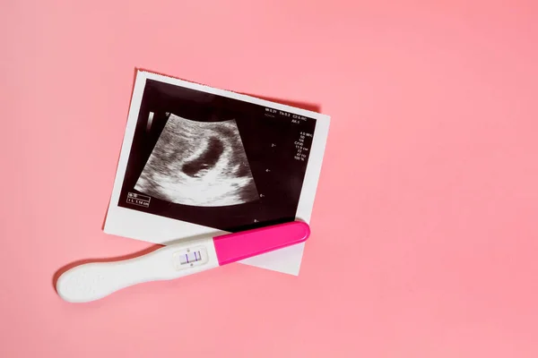 Photo of ultrasound and pregnancy test on a pastel pink background. Positive pregnancy test.