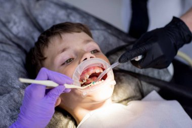Çocuk dişçiliği. Dişçide ilk muayene. Doktor dişlerini tedavi ederken ağzı açık yakışıklı bir çocuk yan bakıyor.
