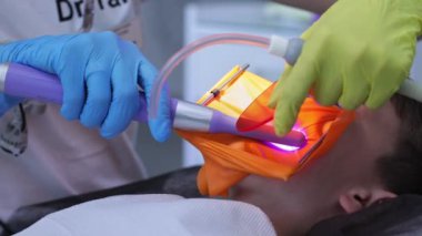 Bir çocuk diş kliniğinde bakıcılık yapıyor. Bir çocuğun hastalıklı dişini dolduran modern fotopolimer yerleştirme süreci.