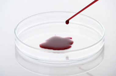 Tıbbi laboratuardaki petri kabına kan damlası ya da kırmızı sıvının yakın plan analizi ve tanı konsepti beyaz arka planda.