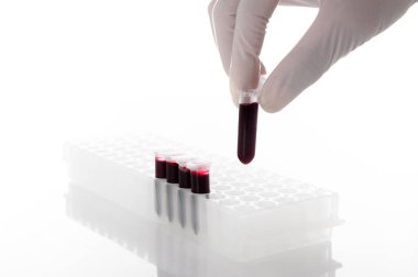 Elle giyilen eldiven, laboratuardaki bir raftan kan örneği ya da kırmızı sıvı alıyor. Beyaz arka planda.