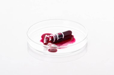 Kırık kan örneği tüpü ya da laboratuardaki bir petri kabına kırmızı sıvı sıçraması. Beyaz arka planda izole edilmiş analiz ve tanı konsepti.