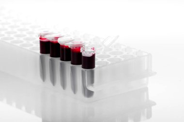 Laboratuvardaki PCR plakasına kan örneği veya kırmızı sıvı beyaz arka planda izole edilmiş.