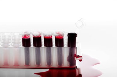 Kırık kan örneği PCR tüpü veya laboratuvardaki PCR plakasında kırmızı sıvı. Biyokimya, moleküler biyoloji, genetik ve klinik kimya kavramı. Beyaz arka planda izole edilmiş.