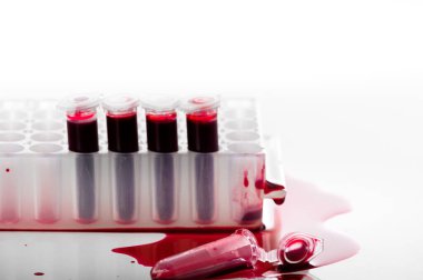 Kırık kan örneği PCR tüpü veya laboratuvardaki PCR plakasında kırmızı sıvı. Biyokimya, moleküler biyoloji, genetik ve klinik kimya kavramı. Beyaz arka planda izole edilmiş.