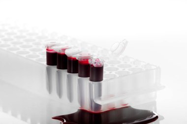 Kırık kan örneği PCR tüpü veya laboratuvardaki PCR plakasında kırmızı sıvı. Biyokimya, moleküler biyoloji, genetik ve klinik kimya kavramı. Beyaz arka planda izole edilmiş.