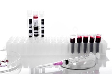 Laboratuvar geçmişinde analiz için kan örneği tüpü ya da kırmızı sıvı. Moleküler biyokimya. Genetik ve klinik kimya kavramları.