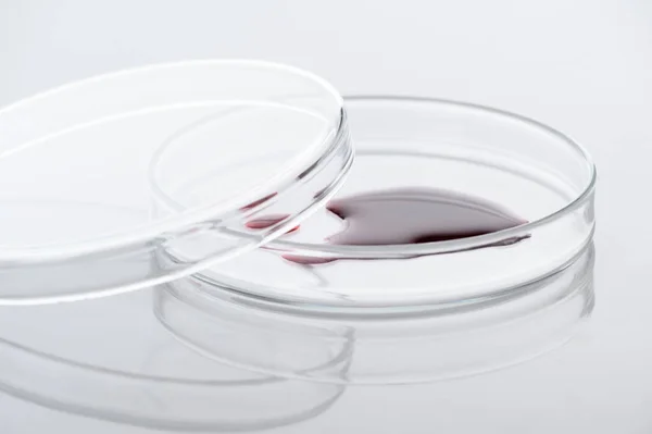 stock image Close-up of blood sample or red chemical liquid on petri dish in the medical laboratory- analyzes and diagnostics concept- on white background